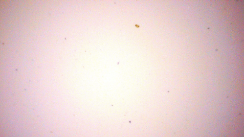 Microscope view of the follow-up membrane patch with fewer visible specks